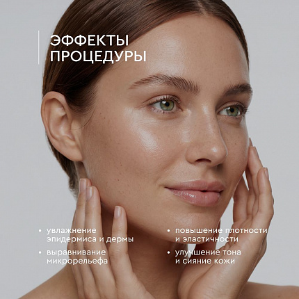 Гион Софт Лайн 1,2% (12 мг), шприц АНГИОФАРМ, 1 мл